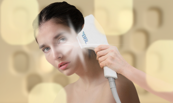 6 вопросов про BBL — аппаратную процедуру для омоложения кожи